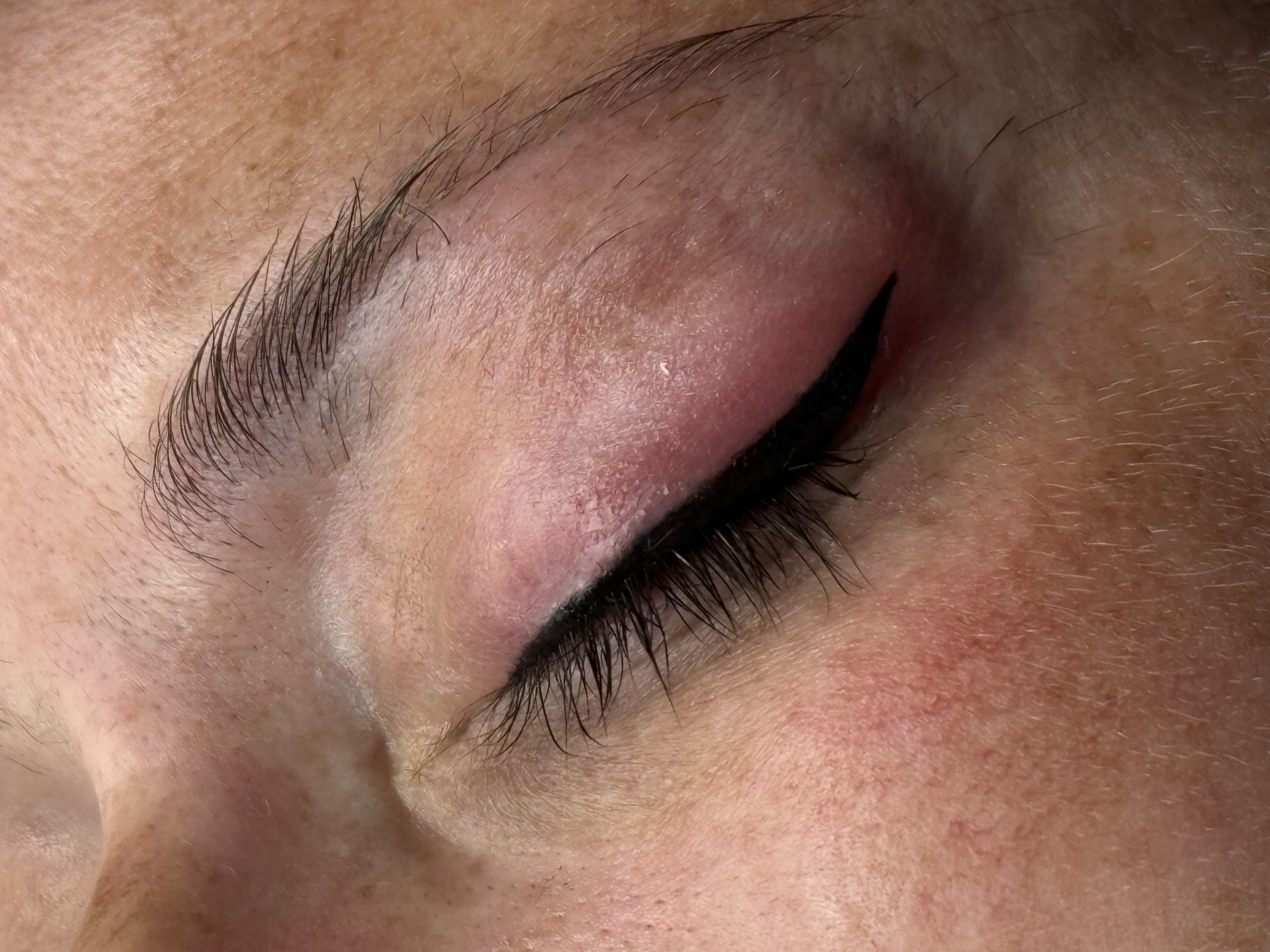 Resultados de Micropigmentación para Cejas, Pestañas y Labios