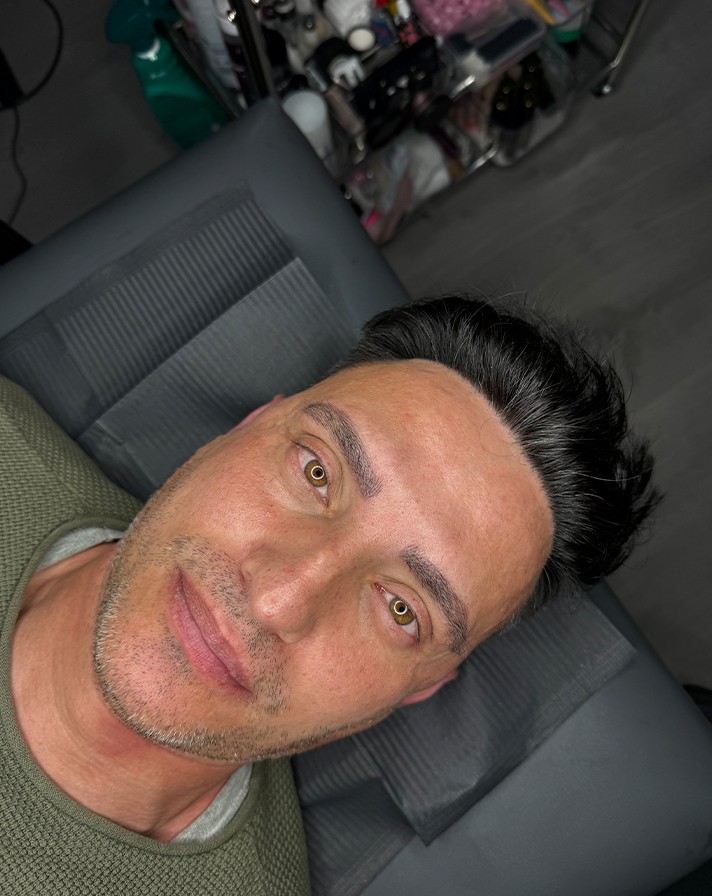 Resultados de Micropigmentación para Cejas, Pestañas y Labios