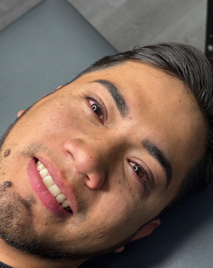 Resultados de Micropigmentación para Cejas, Pestañas y Labios