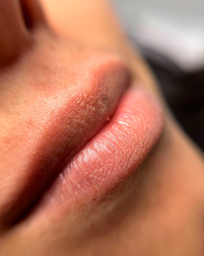 Resultados de Micropigmentación para Cejas, Pestañas y Labios
